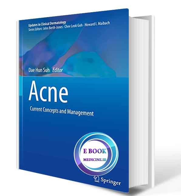 دانلود کتاب  Acne: Current Concepts and Management (Updates in Clinical Dermatology)  2021 (ORIGINAL PDF)